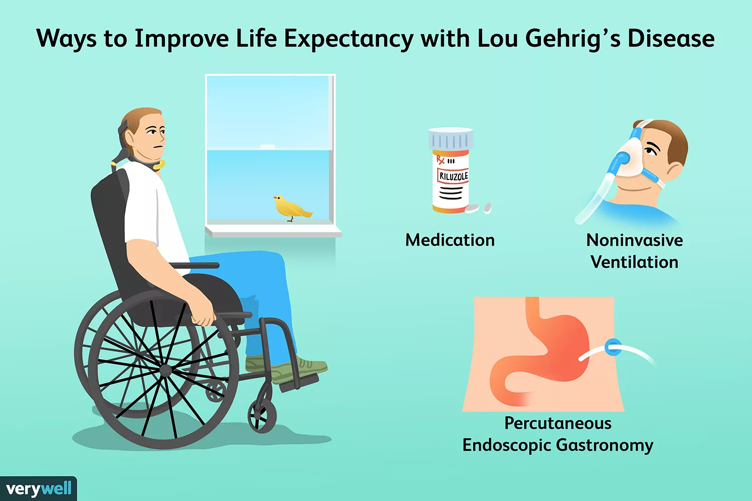 改善渐冻症预期寿命的方法