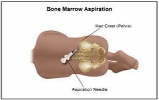 从骨髓中分离干细胞