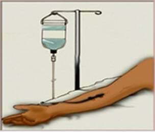 静脉注射图像。