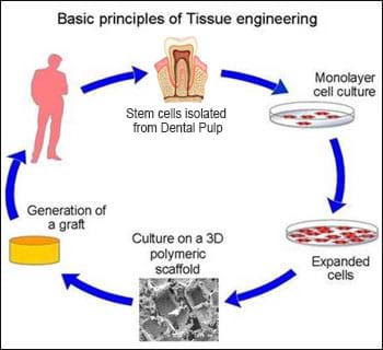  通过生物可降解支架进行组织重建
