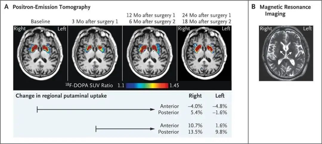 - 断层扫描图像 - - 断层扫描图像 -