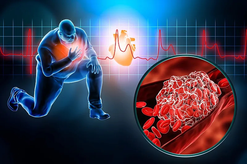 间充质干细胞治疗心血管疾病的临床研究进展