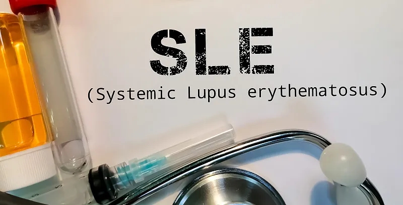 南京鼓楼医院：干细胞治疗在系统性红斑狼疮中维持长期治疗效果