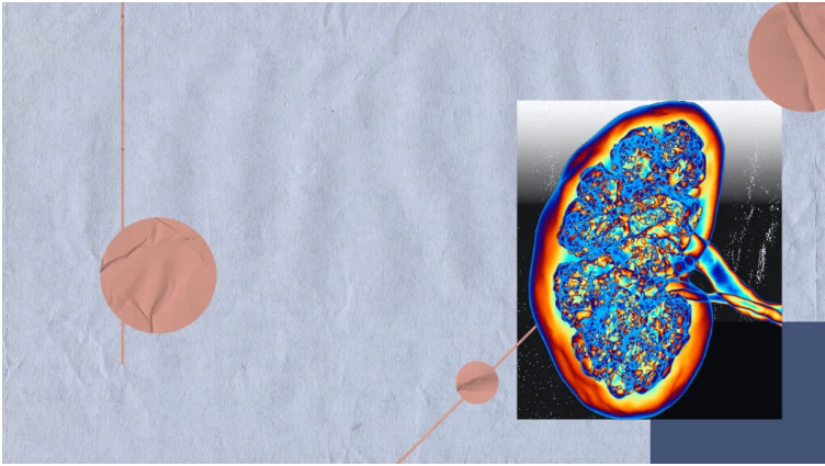 如何筛查糖尿病肾病-有哪些方法? 如何筛查糖尿病肾病-有哪些方法?