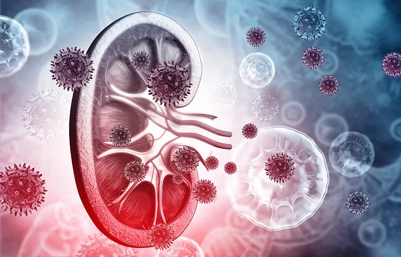 狼疮性肾炎的体征和症状是什么?及其治疗方法 狼疮性肾炎的体征和症状是什么?及其治疗方法