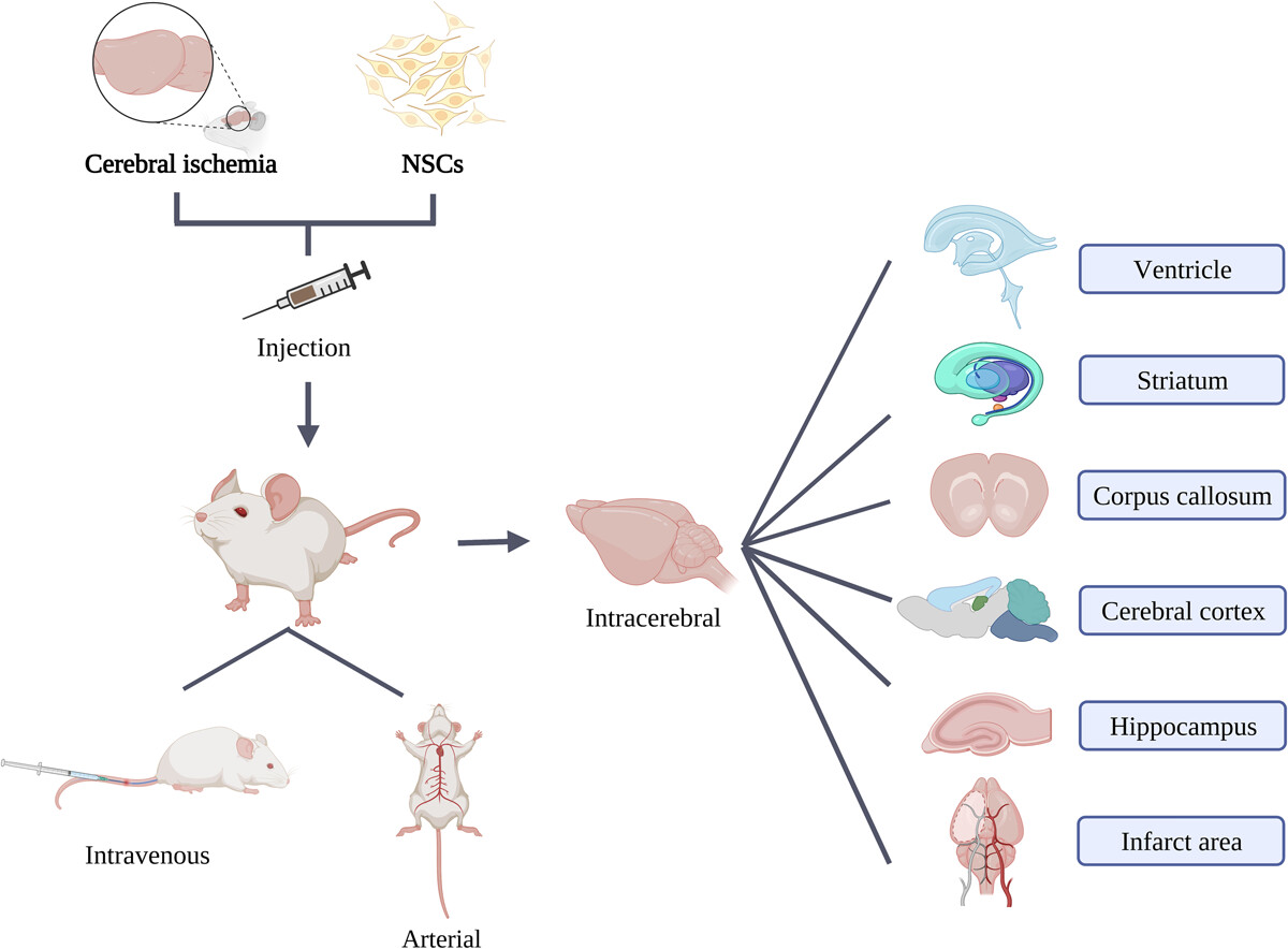 图1：神经干细胞（NSC）注射治疗脑缺血的途径