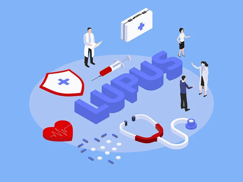 了解狼疮-症状-诊断-治疗