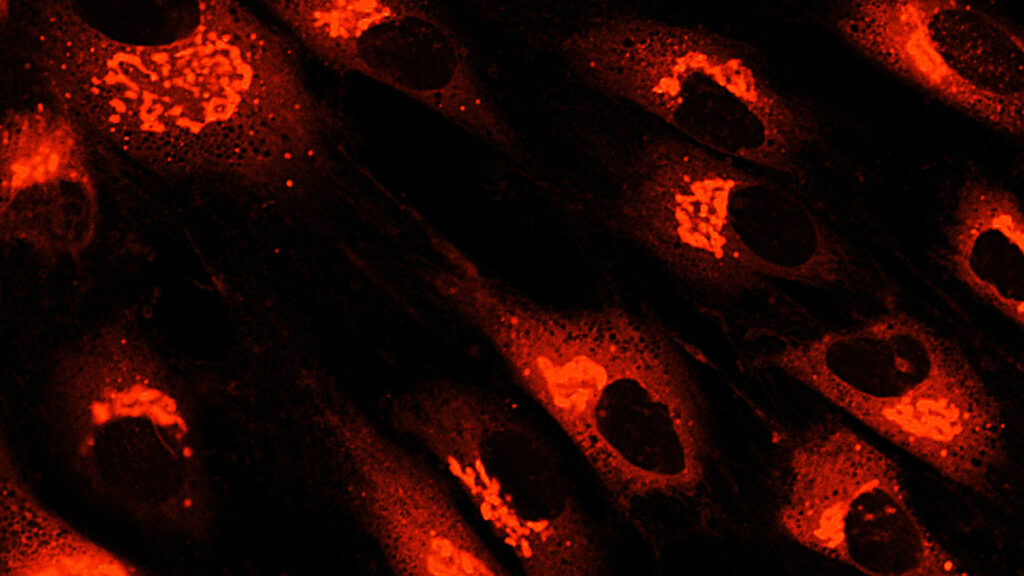 间充质干细胞衍生疗法和外泌体作为先进疗法的后起之秀