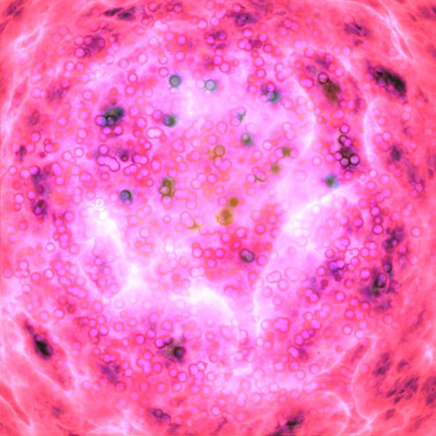 干细胞简介| 帕金森病的干细胞治疗