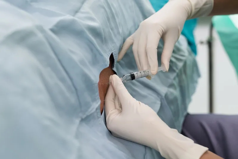 干细胞，-鞘内给药，-神经系统疾病