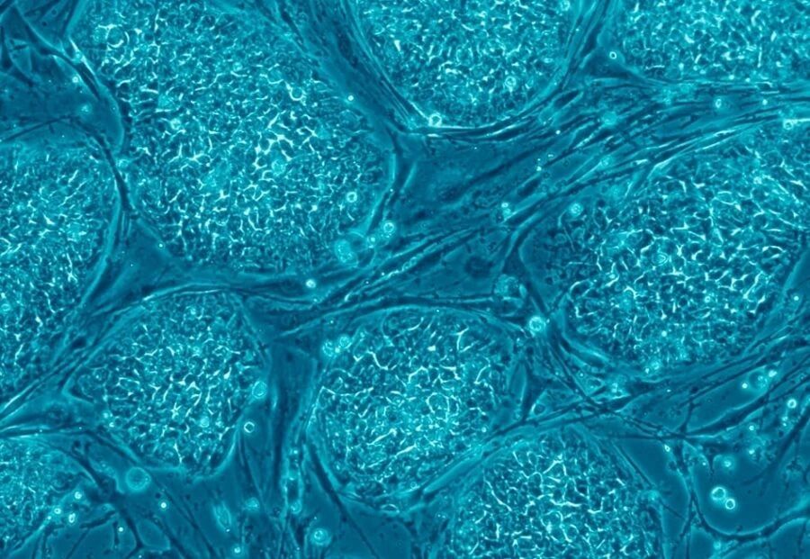 显微镜下被染成蓝色的胚胎干细胞