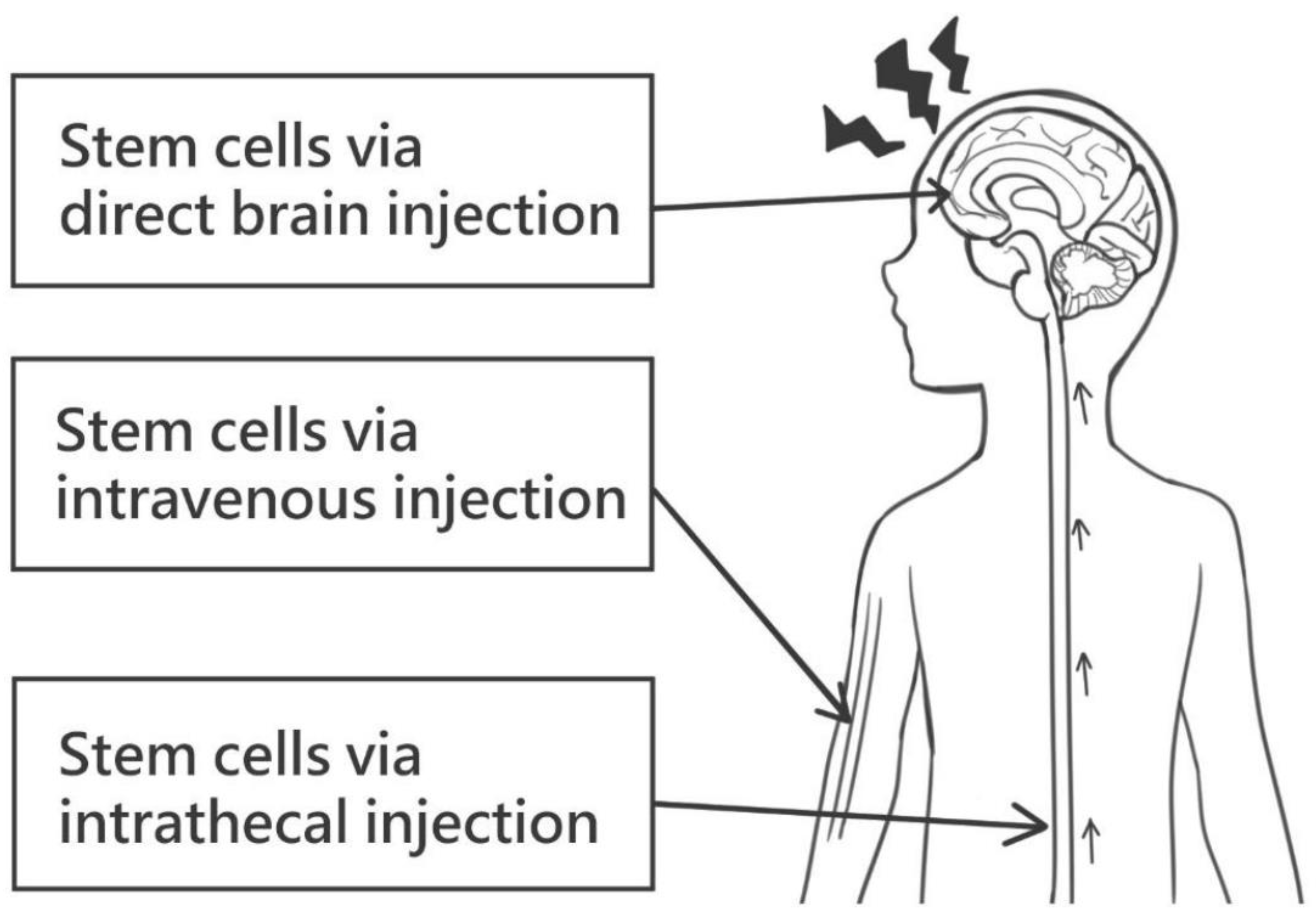 图1：干细胞给药的各种途径。这些可能包括直接脑注射、静脉注射和鞘内注射。