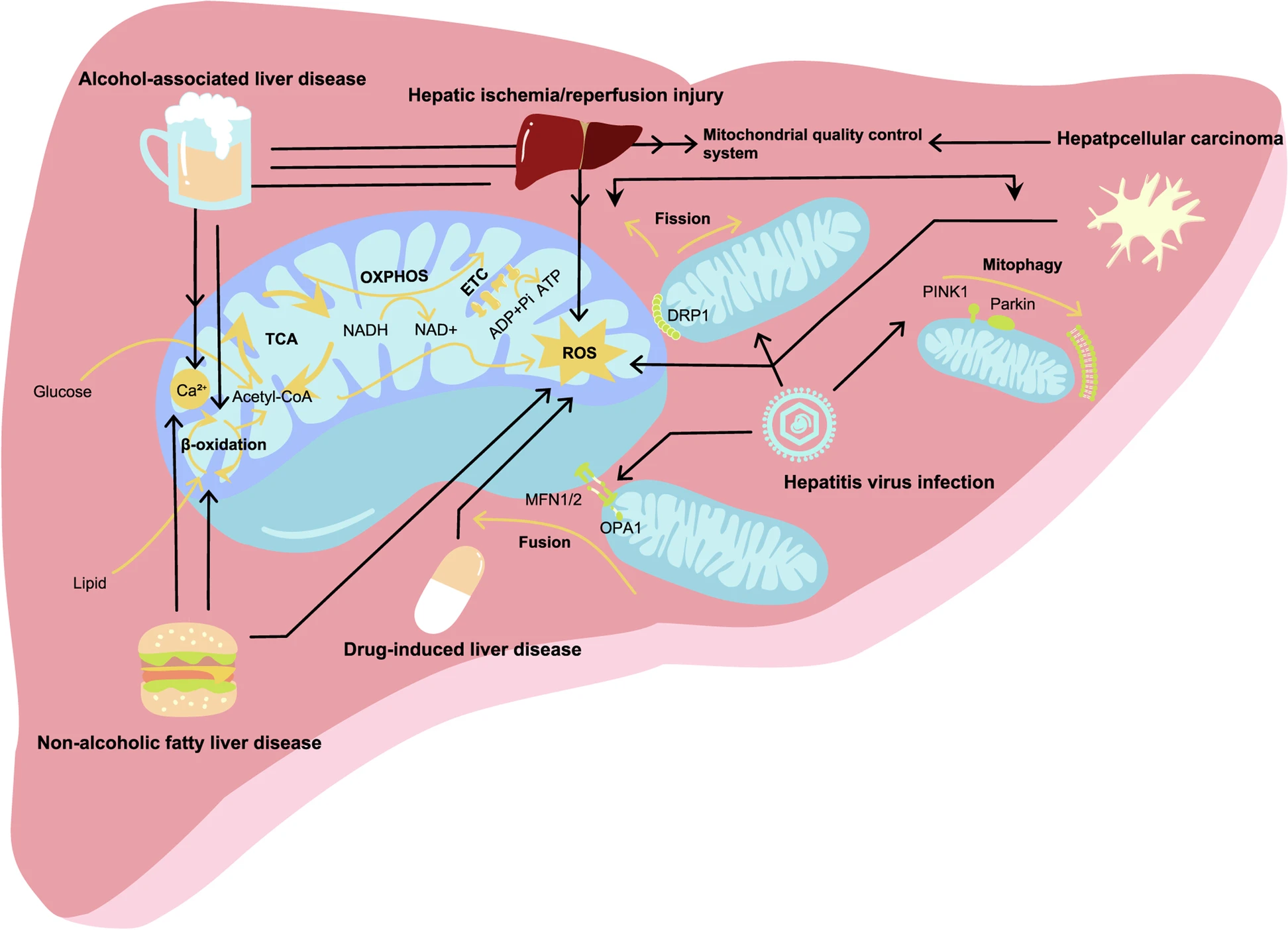 图1：肝病中常见的线粒体功能障碍
