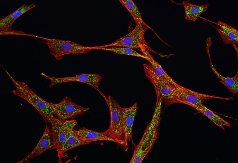 什么是间充质干细胞，间充质干细胞来源于哪里？