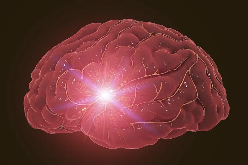 神经干细胞移植治疗缺血性卒中的作用 神经干细胞移植治疗缺血性卒中的作用