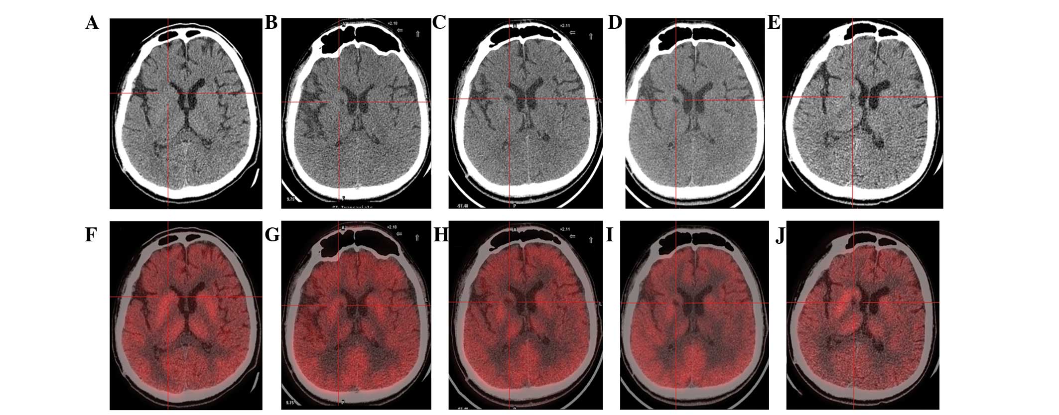 图1：计算机断层扫描 (CT) 和正电子发射断层扫描 (PET) 扫描。