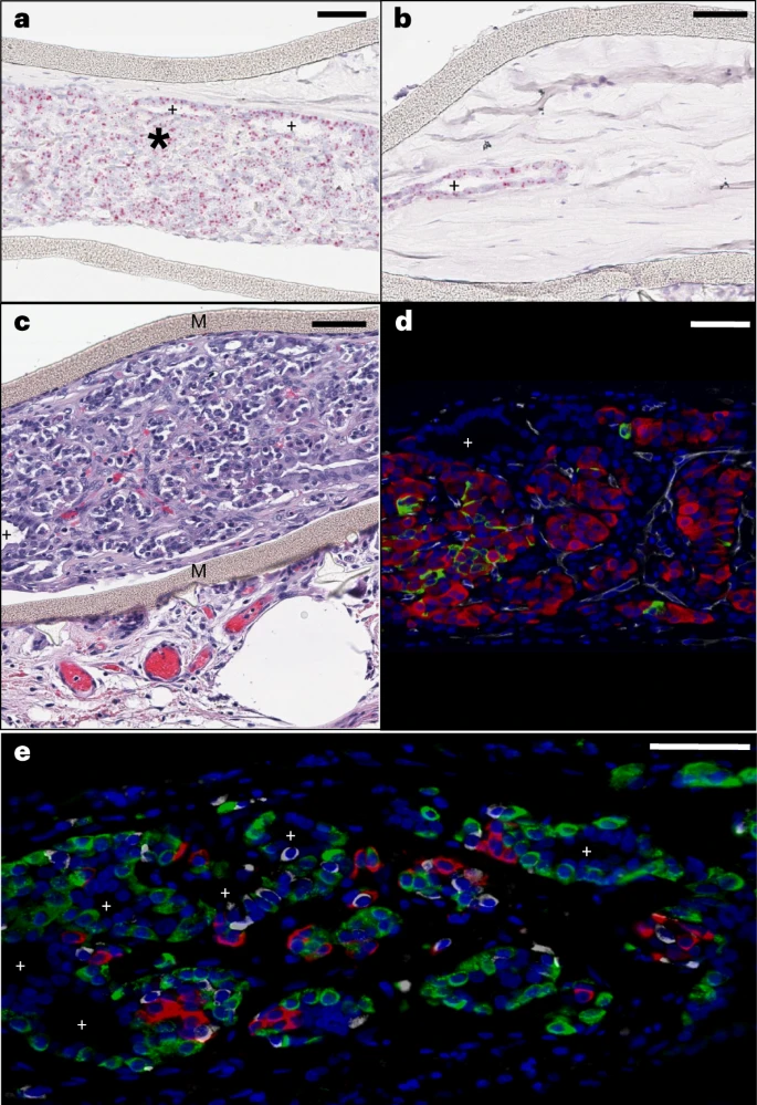 图3：植入后第6个月时装置封装的人类干细胞衍生植入物的成分。