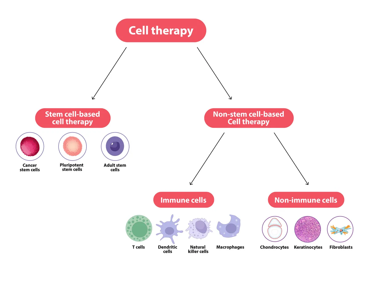 不同类型的细胞疗法