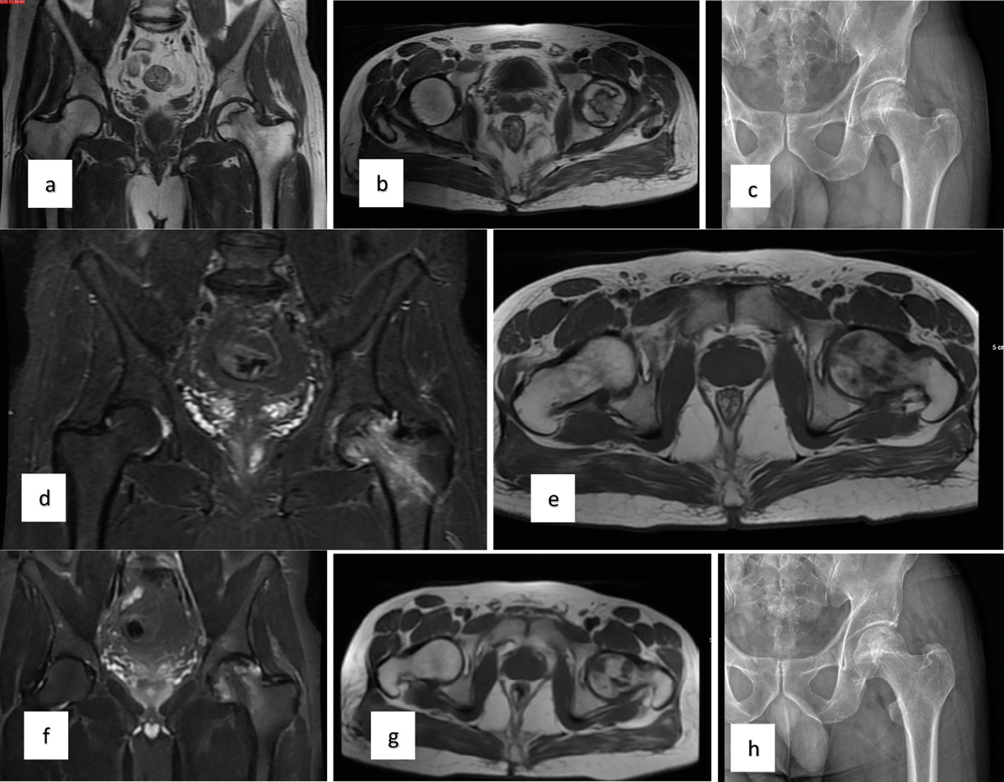 对患者的术前、3个月、6个月、1年和2年随访进行评估（图1）。