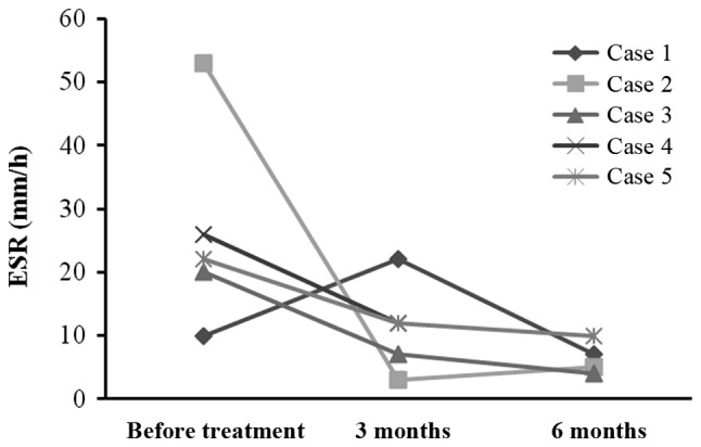 图3:每位患者在治疗前后的ESR。3例患者血沉明显下降