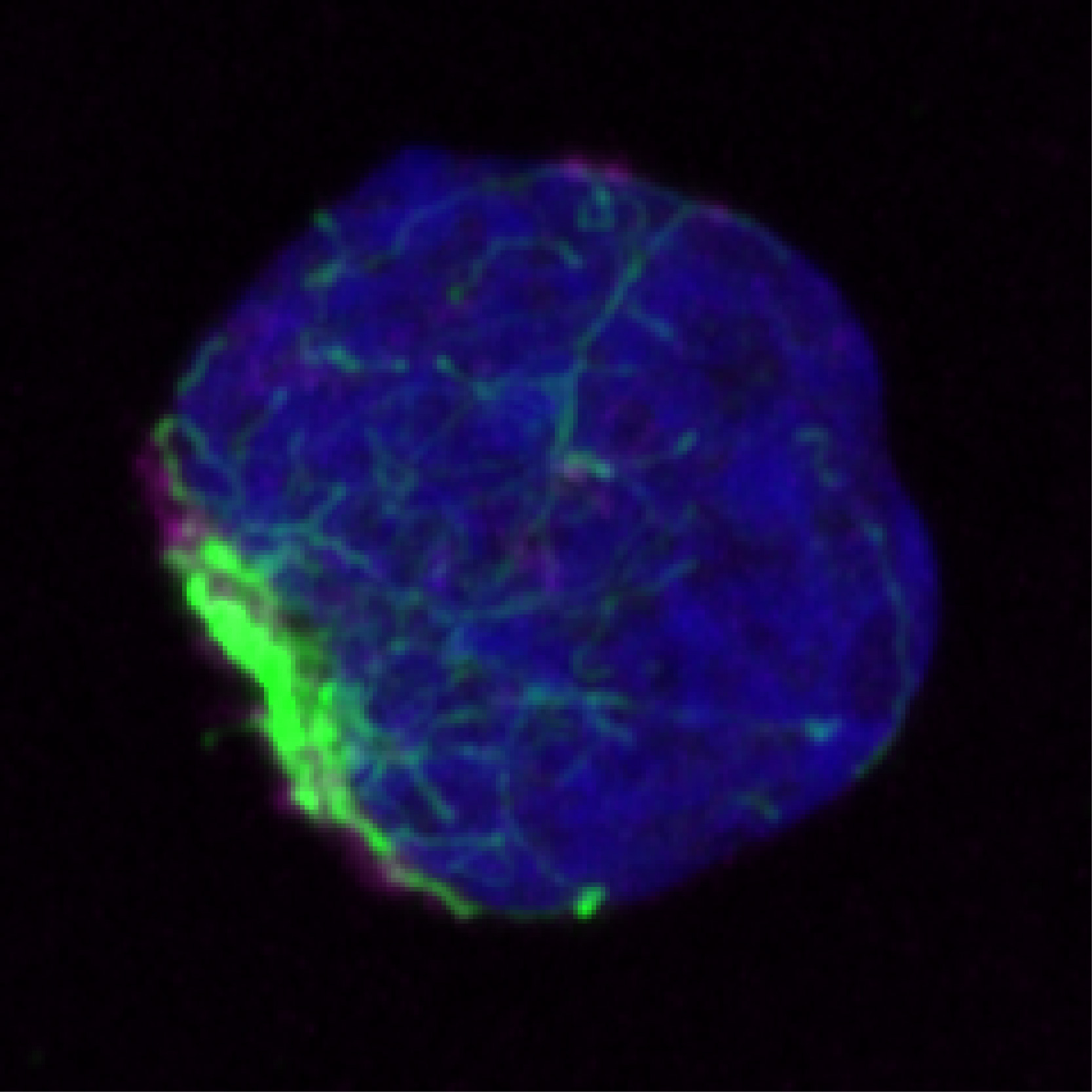 加州大学圣地亚哥分校的科学家发现，错误折叠的蛋白质在被处理之前聚集并被限制在干细胞内的单个区域（绿色）中。