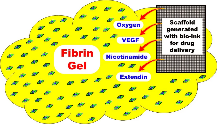 图1：建议的MSC衍生IPC皮下移植模型。