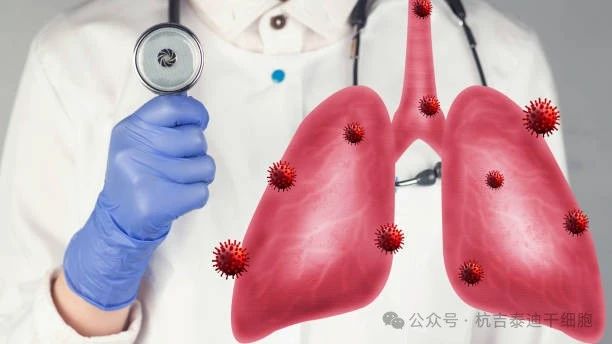 干细胞疗法如何减缓肺部疾病的症状? 干细胞疗法如何减缓肺部疾病的症状?