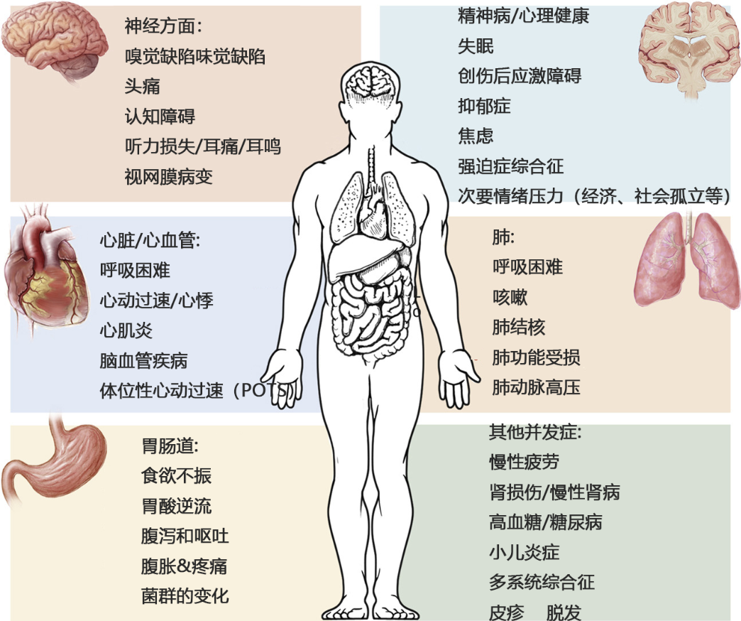 间充质干细胞可改善多种新冠后遗症 间充质干细胞可改善多种新冠后遗症