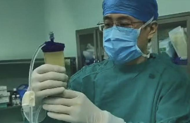 青岛市中心医院：创新脂肪干细胞疗法，为60岁患者解除十年关节炎困扰