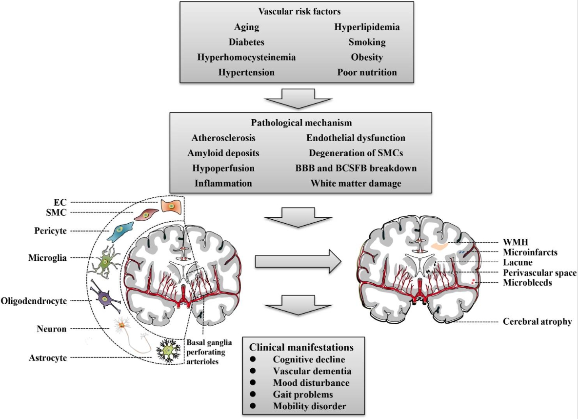 图1：脑小血管病概述