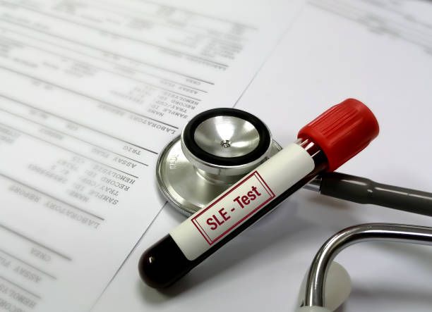 脐带干细胞可以帮助狼疮患者吗？