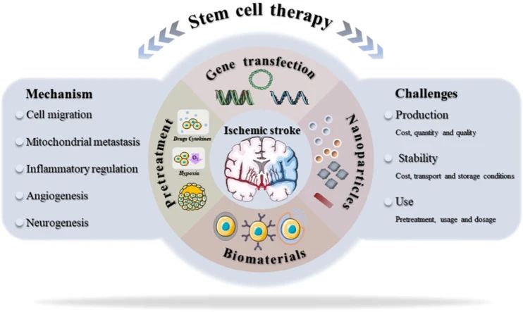 干细胞治疗中风新进展：一项206人的随机临床试验结果揭晓啦！