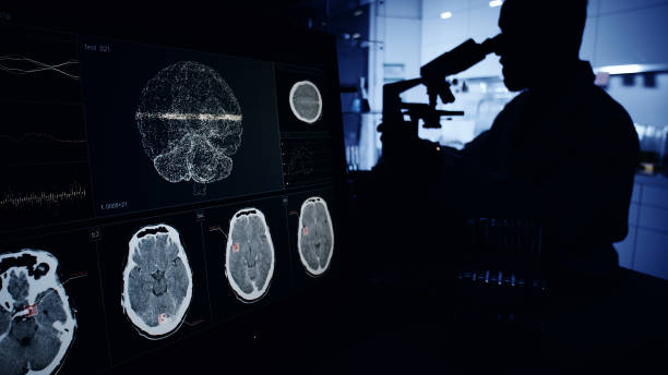 神经系统疾病发病机制复杂，涉及基因突变、衰老过程等多种因素。