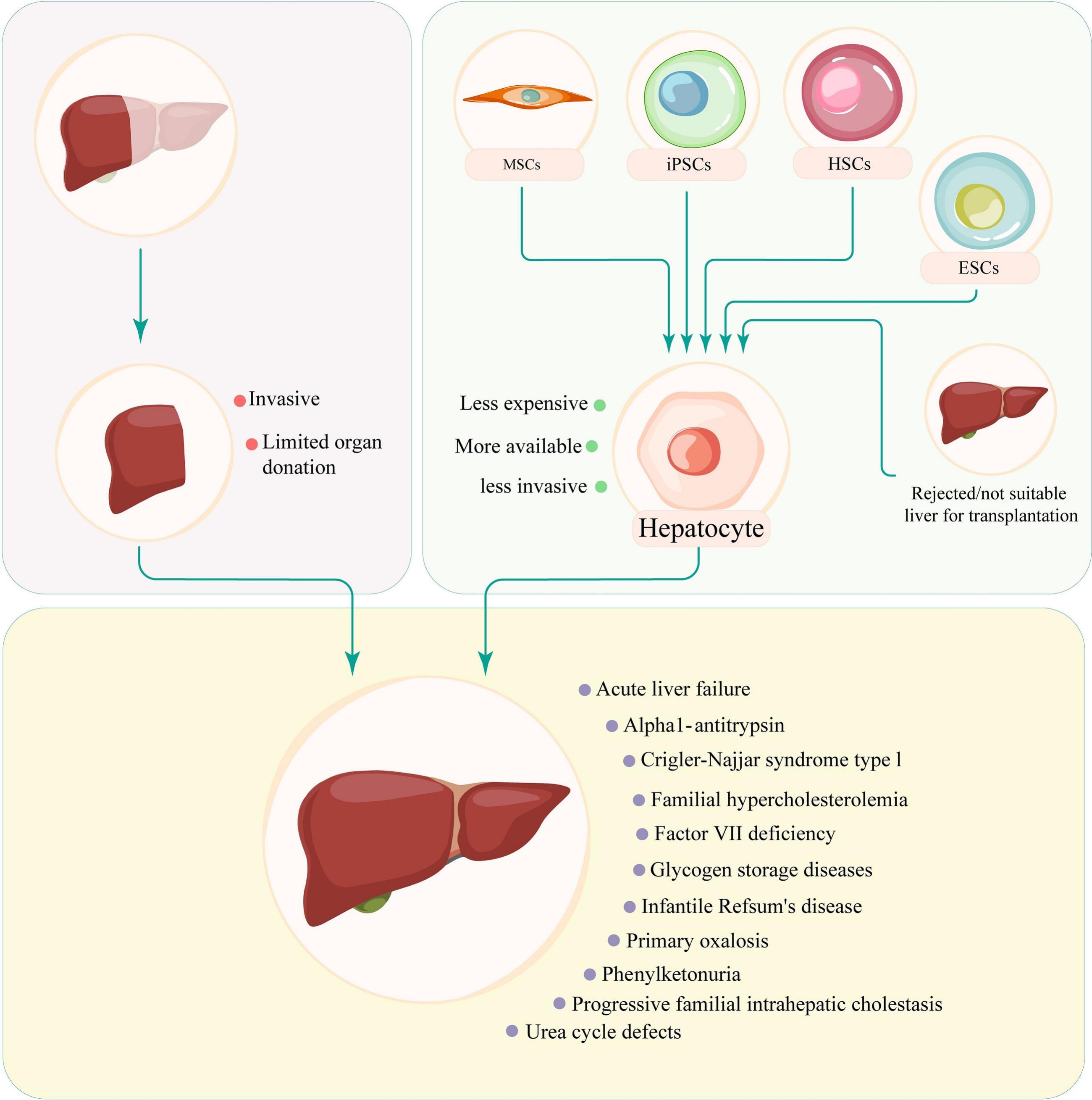 图5：移植和细胞基础疗法治疗肝损伤或疾病的利弊比较。