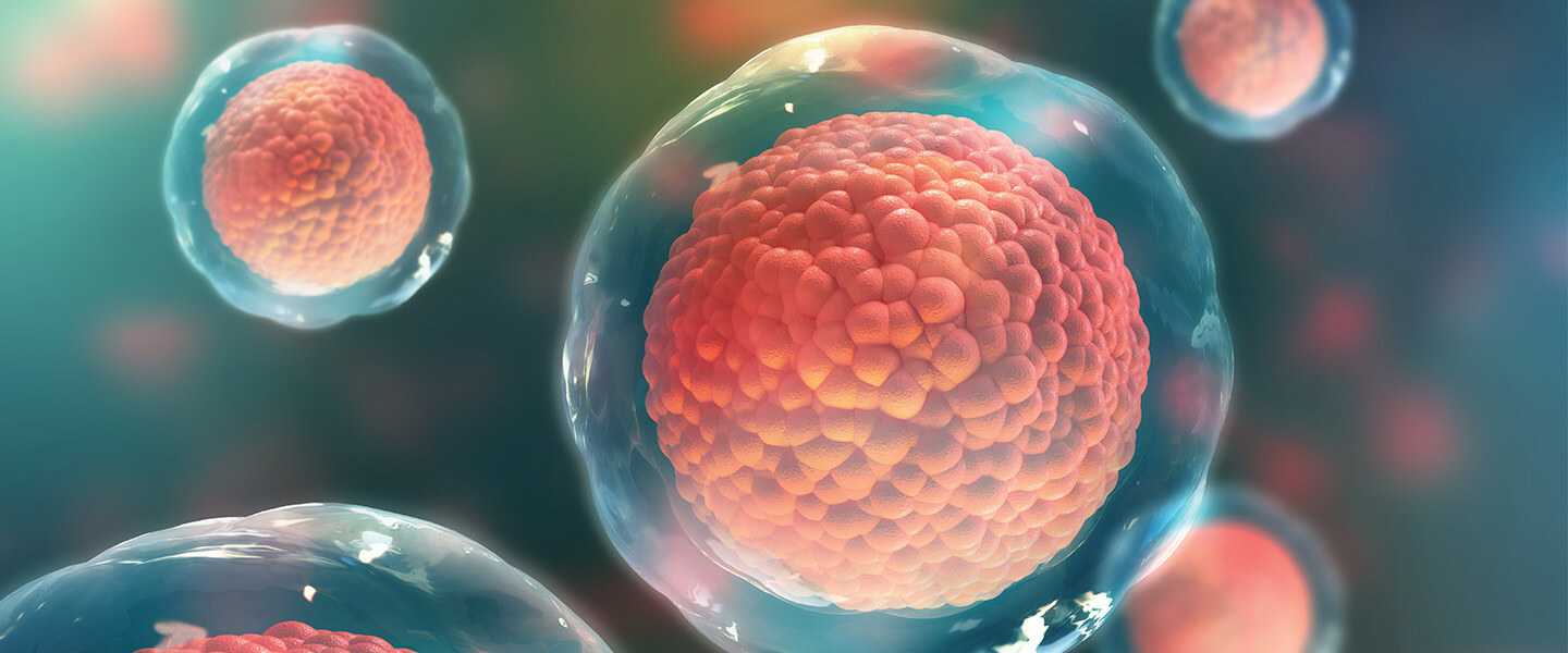 干细胞技术有助于确定精神分裂症的潜在因果机制