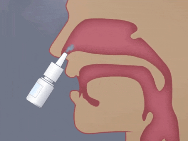 日本居家干细胞喷鼻能治疗脑梗死：是科学突破还是商业噱头？