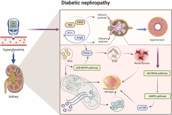 图1:糖尿病肾病的病理信号。 图1:糖尿病肾病的病理信号。
