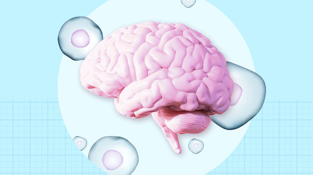 早期数据表明干细胞疗法可以“重置帕金森病的时钟”