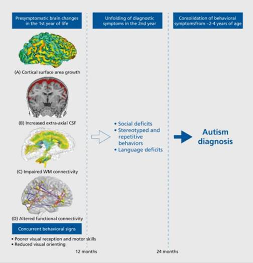 图1：在出现典型自闭症谱系障碍之前，自闭症谱系障碍的可观察大脑特征症状