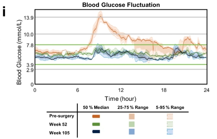 与手术前水平相比,第 52 周和第 105 周的 CGM 测量得出的连续间质葡萄糖波动 与手术前水平相比,第 52 周和第 105 周的 CGM 测量得出的连续间质葡萄糖波动
