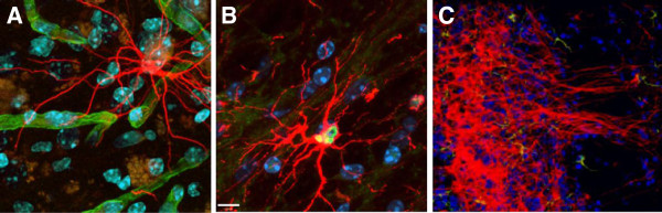 图3:人类中枢神经系统干细胞 (HuCNS-SC) 根据其迁移位点优先分化为特定谱系。 图3:人类中枢神经系统干细胞 (HuCNS-SC) 根据其迁移位点优先分化为特定谱系。