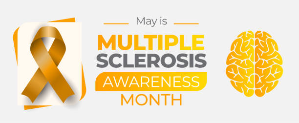 多发性硬化症 (MS) 是一种复杂的自身免疫性疾病 多发性硬化症 (MS) 是一种复杂的自身免疫性疾病