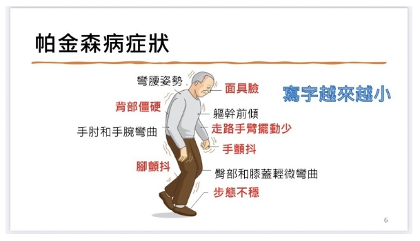 帕金森病症状 帕金森病症状