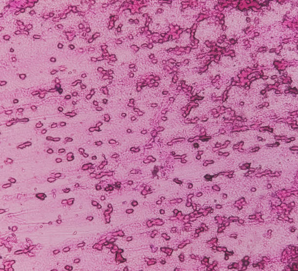 人羊膜上皮细胞对中枢神经系统损伤和疾病的治疗潜力