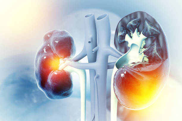 内源性急性肾损伤治疗