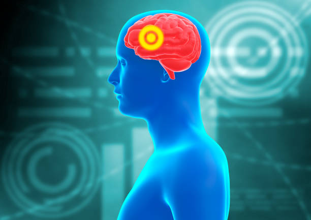 中风患者的康复策略有哪些？