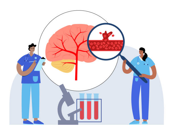 围产期中风-类型、原因和风险因素