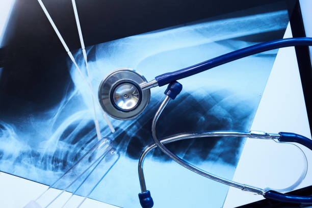 干细胞治疗在风湿病中的作用