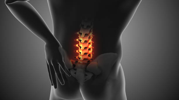 干细胞治疗强直性脊柱炎的临床案例有哪些?