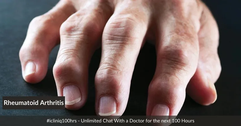 类风湿关节炎的体征和症状是什么？及其治疗方法